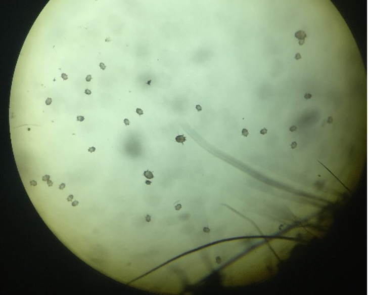 Sarcoptes mange mites under microscope